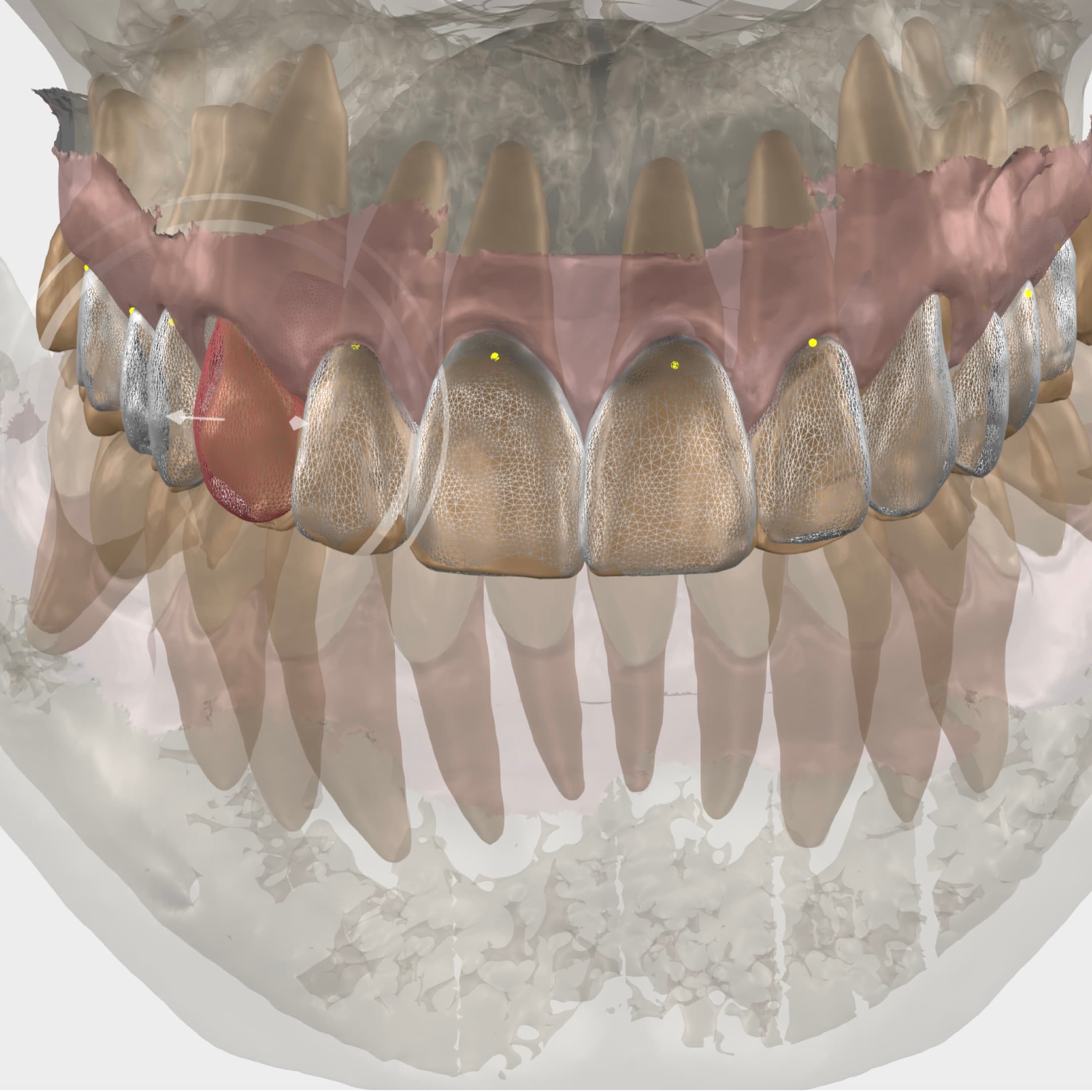 Smilecloud Blueprint – Singular Design for Interdisciplinary Dentistry