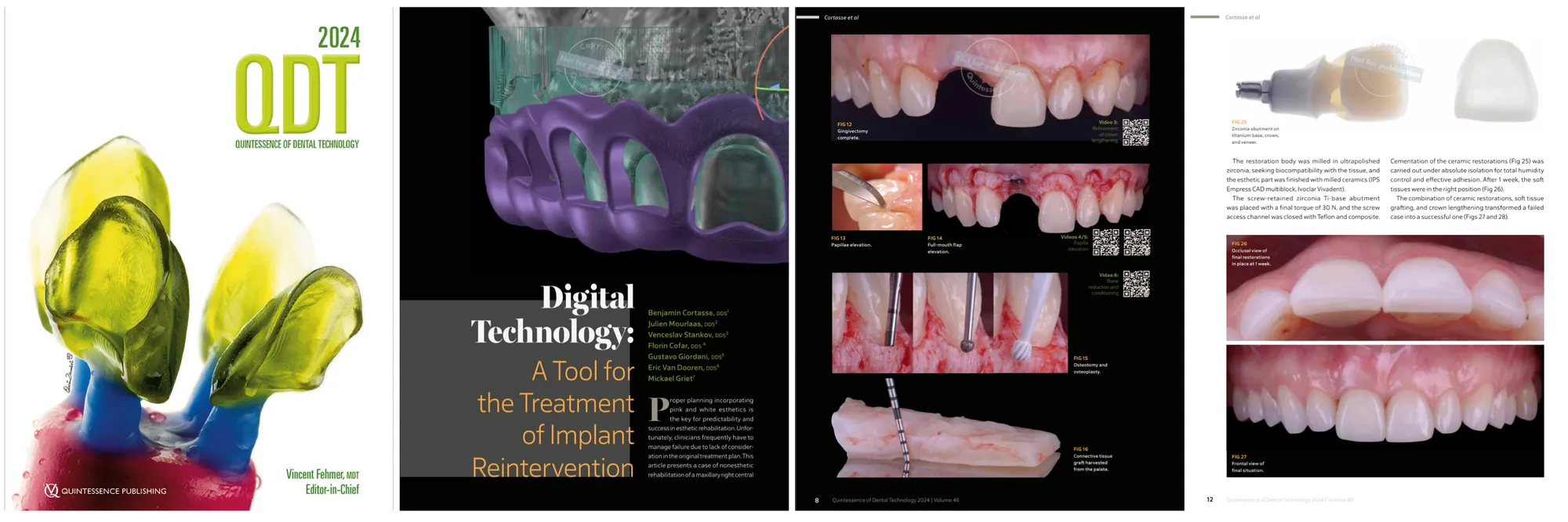 Digital Technology: A Tool for the Treatment of Implant Reintervention