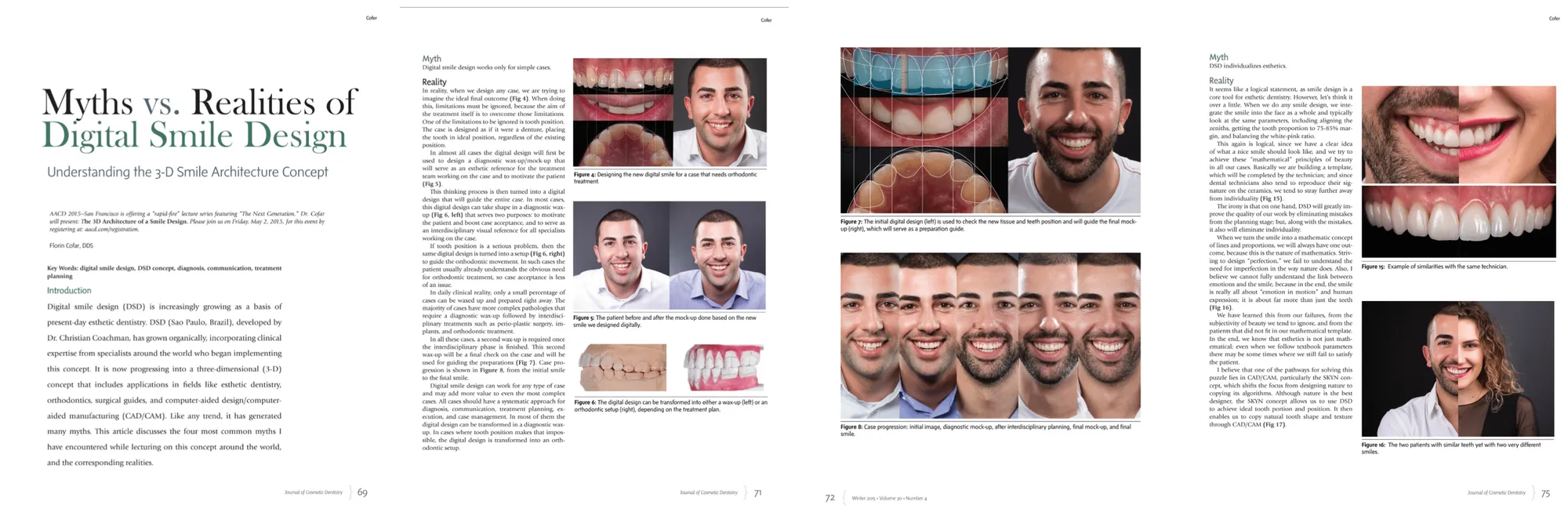 Myths vs. Realities of Digital Smile Design