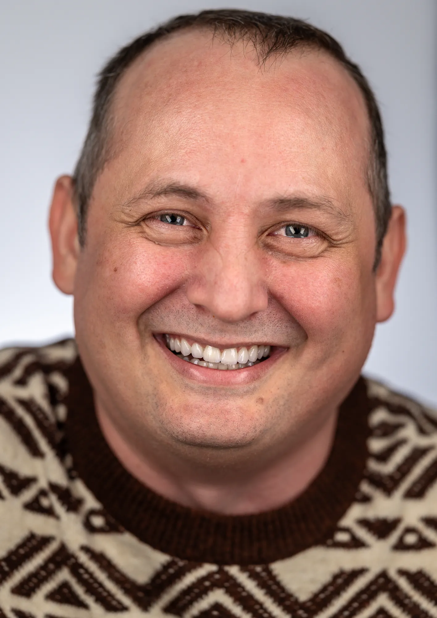 Dinți frontali compromiși înlocuiți: ortodonție, implanturi și grefe