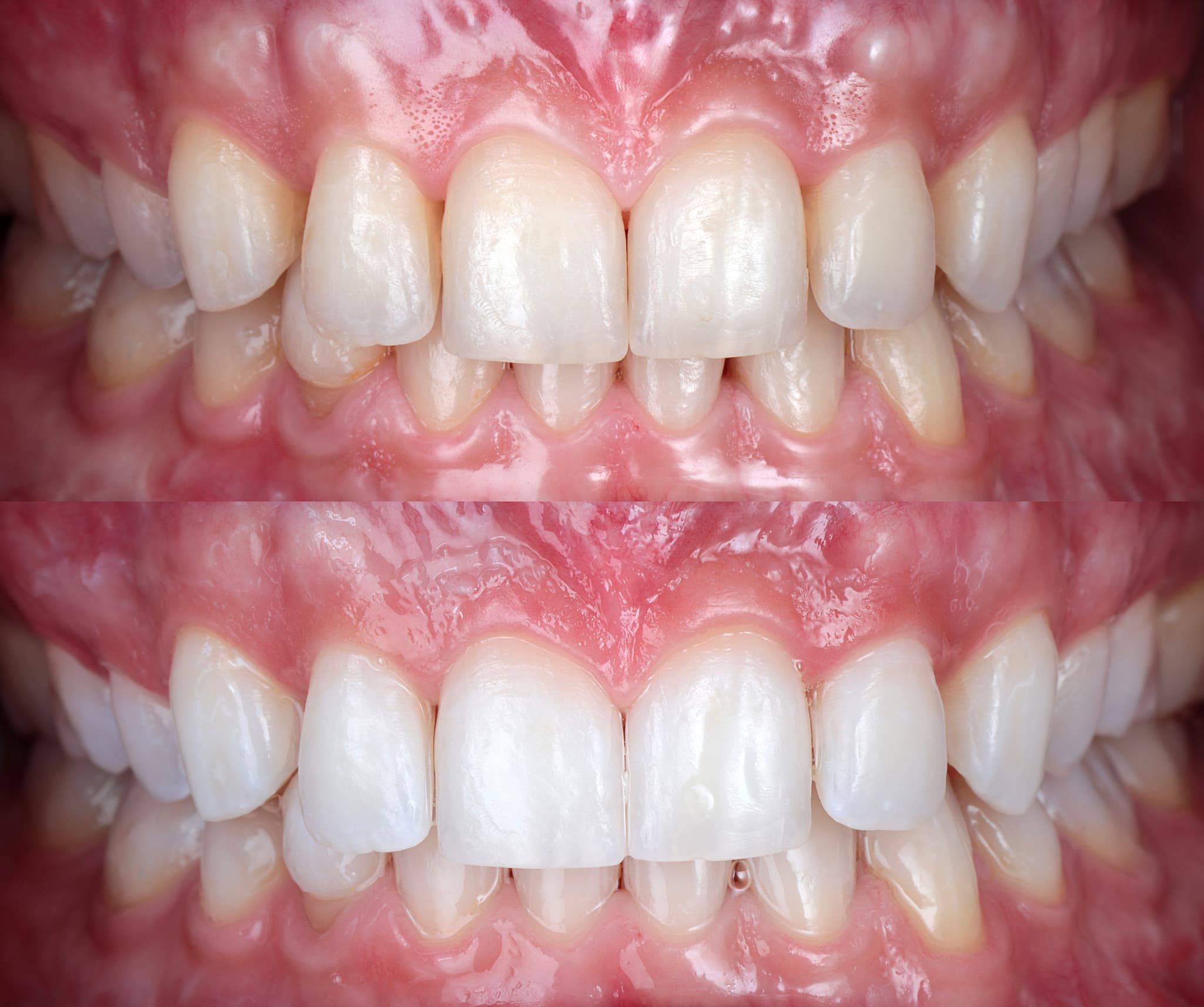 0A7A6729_Before and after-1