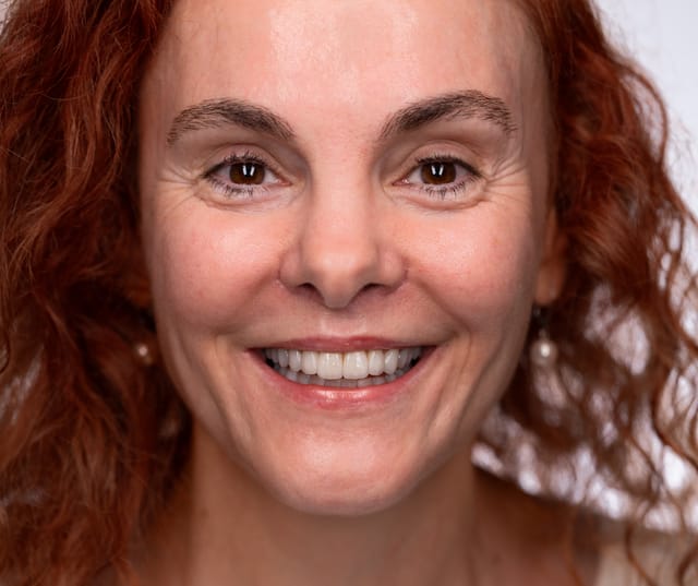 Vedere frontală după retreatment total