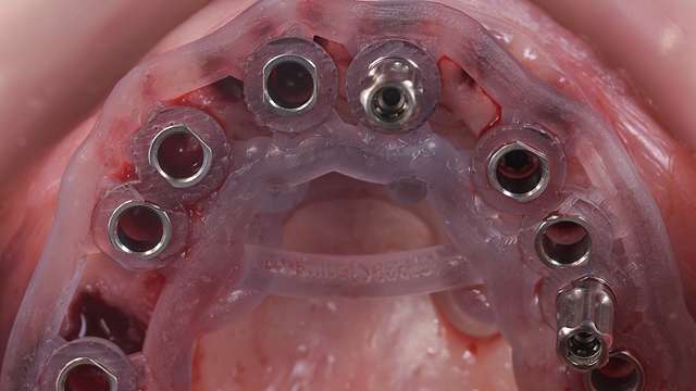 fixed-prosthodontics