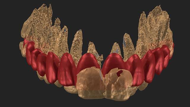 panoramic-ortho