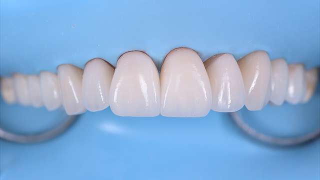 teeth-4