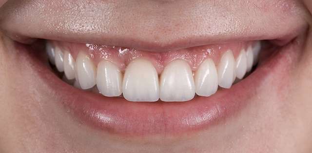 teeth-15