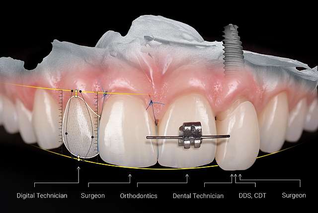 teeth-03