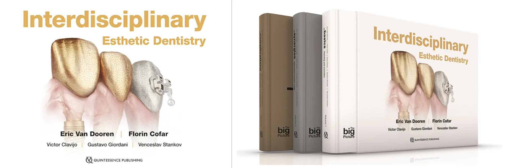 Interdisciplinary Esthetic Dentistry: The Big Picture